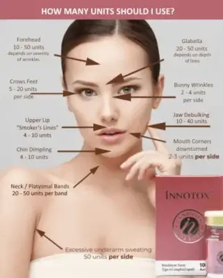 innotox dosage